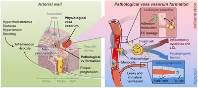 Vasa Vasorum Angiogenesis: Key Player in the Initiation and Progression of Atherosclerosis and Potential Target for the Treatment of Cardiovascular Disease